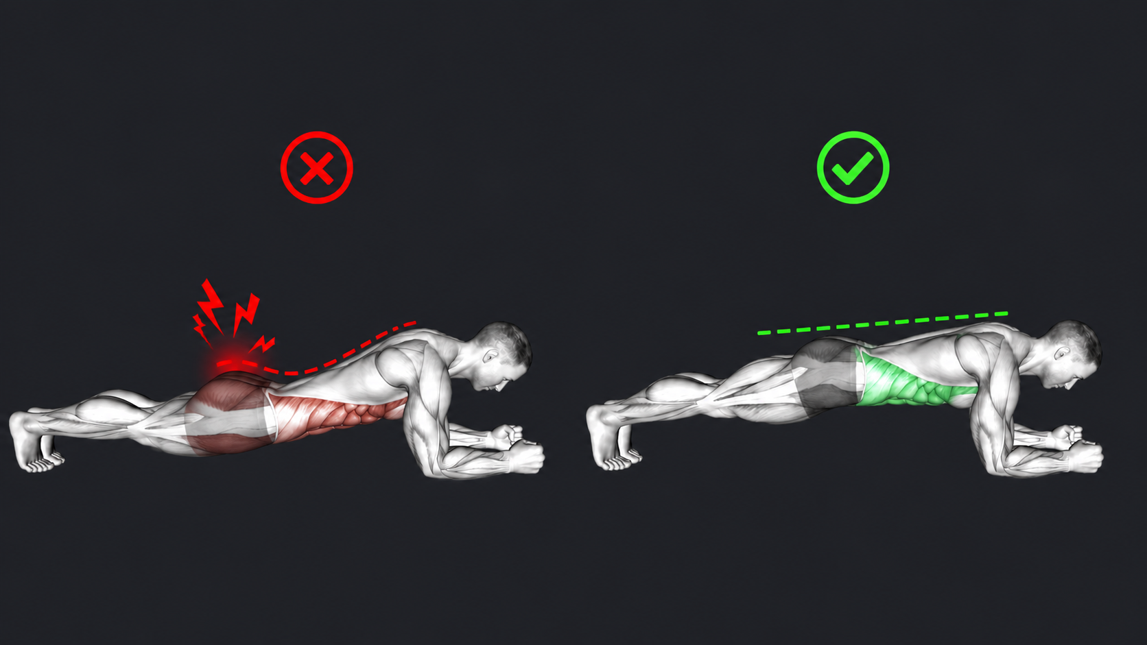 Plank — Hips sag